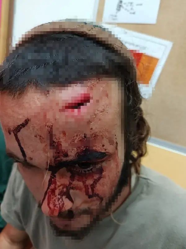 Жестокое нападение на пастуха в Гуш-Эционе
